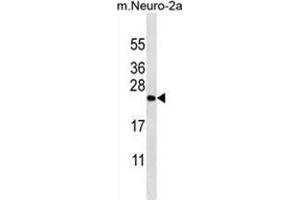 ZCRB1 Antibody (C-term) western blot analysis in mouse Neuro-2a cell line lysates (35 µg/lane).