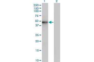 Western Blot analysis of ZNF24 expression in transfected 293T cell line by ZNF24 monoclonal antibody (M02), clone 2G5. (ZNF24 抗体  (AA 1-368))