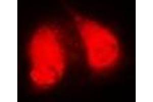 Immunofluorescence (IF) image for anti-Golgi-Associated, gamma Adaptin Ear Containing, ARF Binding Protein 2 (GGA2) antibody (ABIN7305940)
