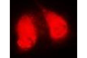 Immunofluorescent analysis of GGA2 staining in MCF7 cells. (GGA2 抗体)