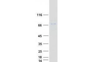 Western Blotting (WB) image for ERO1-Like Protein alpha (ERO1L) protein (Myc-DYKDDDDK Tag) (ABIN2720503)