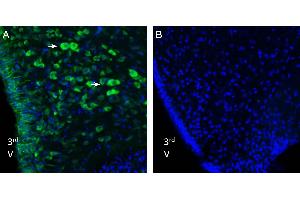 anti-Nucleobindin 2 (NUCB2) (AA 30-44), (Intracellular) antibody