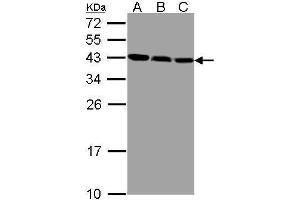 WB Image Sample(30 ug whole cell lysate) A:293T B:MOLT4 , C:Raji , 12% SDS PAGE antibody diluted at 1:1000 (ZWINT 抗体  (Center))