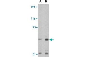 Western blot analysis of TNPO3 in Raji cell lysate with TNPO3 polyclonal antibody  at (A) 1 and (B) 2 ug/mL . (Transportin 3 抗体  (N-Term))