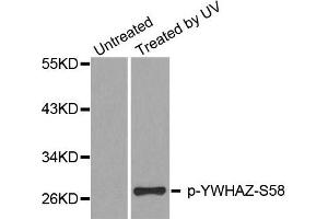 Western Blotting (WB) image for anti-14-3-3 zeta (YWHAZ) (pSer58) antibody (ABIN1870698) (14-3-3 zeta 抗体  (pSer58))