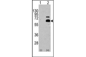 Image no. 1 for anti-Ribosomal Protein S6 Kinase, 70kDa, Polypeptide 1 (RPS6KB1) (Ser404) antibody (ABIN358257) (RPS6KB1 抗体  (Ser404))
