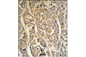 DCD Antibody (C-term) (R) IHC analysis in formalin fixed and paraffin embedded human skin tissue followed by peroxidase conjugation of the secondary antibody and DAB staining. (Dermcidin 抗体  (C-Term))