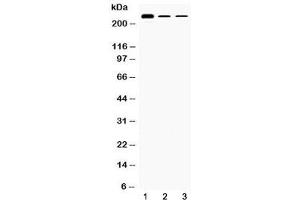 Western blot testing of 1) rat testis, 2) mouse Hepa1-6 and 3) human HepG2 lysate with TECTA antibody at 0. (TECTA 抗体  (AA 93-134))