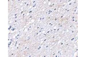 Immunohistochemical staining of human brain tissue using AP30122PU-N BAP3 antibody at 2. (BAIAP3 抗体  (N-Term))