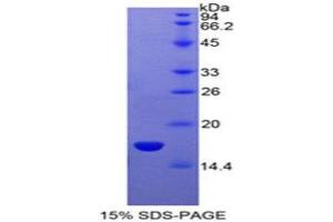 SDS-PAGE (SDS) image for Sema Domain, Immunoglobulin Domain (Ig), Short Basic Domain, Secreted, (Semaphorin) 3A (SEMA3A) (AA 31-141) protein (His tag) (ABIN1880056) (SEMA3A Protein (AA 31-141) (His tag))