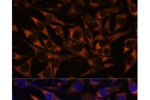 Immunofluorescence analysis of L929 cells using ACAA2 Polyclonal Antibody at dilution of 1:100. (ACAA2 抗体)