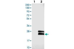 Western blot analysis of Lane 1: Negative control (vector only transfected HEK293T lysate), Lane 2: Over-expression Lysate (Co-expressed with a C-terminal myc-DDK tag (~3. (GAPT 抗体)