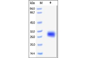 SDS-PAGE (SDS) image for Folate Receptor 2 (Fetal) (FOLR2) (AA 17-228) protein (His tag) (ABIN2181119)