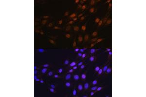 Immunofluorescence (IF) image for anti-Sp1 Transcription Factor (SP1) antibody (ABIN7270505)