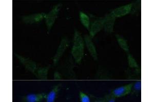 Immunofluorescence analysis of NIH-3T3 cells using ZWINT Polyclonal Antibody at dilution of 1:100 (40x lens). (ZWINT 抗体)