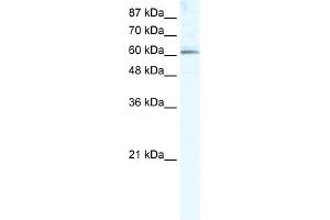 WB Suggested Anti-METTL3 Antibody Titration:  5. (METTL3 抗体  (Middle Region))