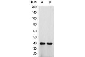 Western blot analysis of ATP6V0D1 expression in HeLa (A), H9C2 (B) whole cell lysates. (ATP6V0D1 抗体  (Center))