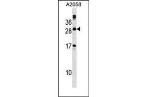 Western blot analysis of PLA2G12A Antibody (Center) in A2058 cell line lysates (35ug/lane). (PLA2G12A 抗体  (Middle Region))