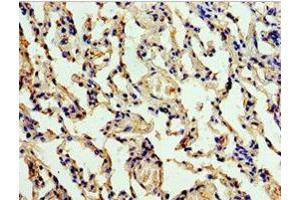 Immunohistochemistry of paraffin-embedded human lung tissue using ABIN7147563 at dilution of 1:100 (ALG1 抗体  (AA 215-464))