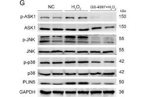The expression of PLIN5 was regulated by the JNK-p38-ATF pathway. (MAPK14 抗体  (pThr180, pTyr182))