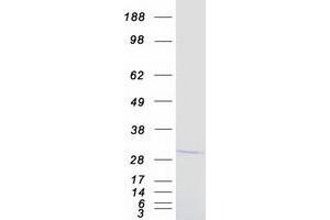 Validation with Western Blot