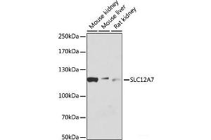 Western blot analysis of extracts of various cell lines using SLC12A7 Polyclonal Antibody at dilution of 1:1000. (SLC12A7 抗体)