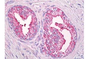 Anti-USP21 antibody IHC of human prostate. (USP21 抗体  (AA 466-566))