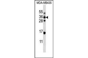 Western blot analysis of ELOVL5 Antibody (C-term) in MDA-MB435 cell line lysates (35ug/lane). (ELOVL5 抗体  (C-Term))
