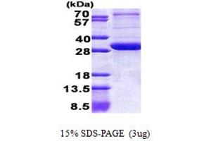 SDS-PAGE (SDS) image for Peroxisomal Biogenesis Factor 26 (PEX26) (AA 1-246) protein (His tag) (ABIN5853072) (PEX26 Protein (AA 1-246) (His tag))