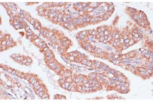 Immunohistochemistry (Paraffin-embedded Sections) (IHC (p)) image for anti-Cell Division Cycle 20 Homolog (S. Cerevisiae) (CDC20) antibody (ABIN7258562)