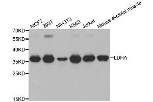 Western blot analysis of extracts of various cell lines, using LDHA antibody. (Lactate Dehydrogenase A 抗体  (AA 1-332))