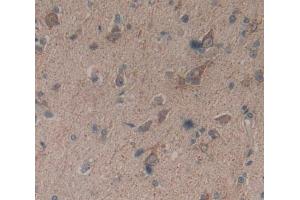 #VALUE! (Basonuclin 1 抗体  (AA 43-246))