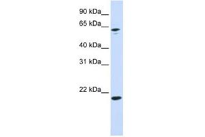 APRT antibody used at 1 ug/ml to detect target protein. (APRT 抗体  (N-Term))