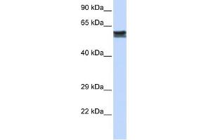 WB Suggested Anti-FYN Antibody Titration: 0. (FYN 抗体  (N-Term))