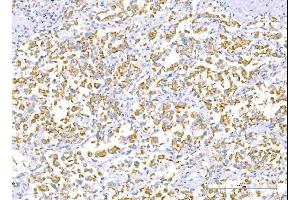 IHC analysis of RALBP1 using anti-RALBP1 antibody (ABIN7600800). (RALBP1 抗体  (AA 239-506))