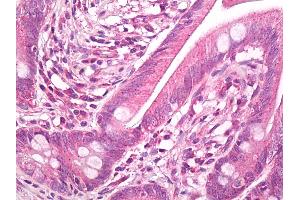 Anti-HSP27 / Heat Shock Protein 27 antibody IHC of human small intestine.