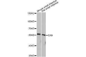Western blot analysis of extracts of various cell lines, using CA9 Antibody. (CA9 抗体)