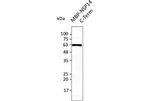 Western Blotting (WB) image for anti-SARS-CoV-2 Guanine-N7 Methyltransferase (NSP14) (ExoN) (C-Term) antibody (ABIN7273006) (SARS-CoV-2 NSP14 抗体  (C-Term))