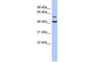 WB Suggested Anti-OLFML1 Antibody Titration: 0. (OLFML1 抗体  (N-Term))