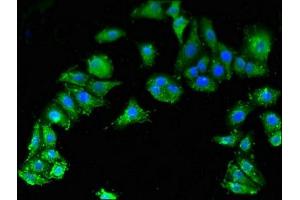 Immunofluorescent analysis of HepG2 cells using ABIN7171024 at dilution of 1:100 and Alexa Fluor 488-congugated AffiniPure Goat Anti-Rabbit IgG(H+L) (SMN1 抗体  (AA 3-194))