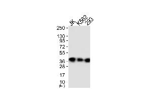 Western blot analysis of extracts from JK cells (Lane 1), K562 cells (Lane 2) and 293 cells (Lane 3), using ANXA1 (Ab-21) Antibody. (Annexin a1 抗体)