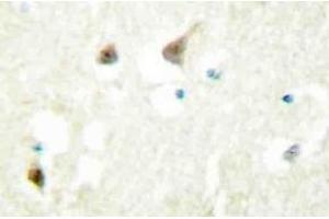 Immunohistochemistry (IHC) analyzes of hnRNP C1/C2 antibody in paraffin-embedded human brain tissue. (HNRNPC 抗体)
