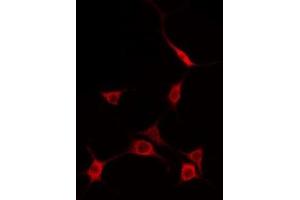 ABIN6275119 staining A549 by IF/ICC. (EIF2AK1 抗体  (C-Term))