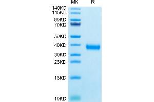 SDS-PAGE (SDS) image for SARS-CoV-2 Spike (P.1 - gamma), (RBD) protein (His tag) (ABIN7274758)