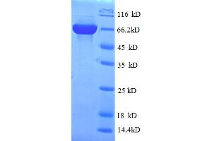 SDS-PAGE (SDS) image for Phospholipase D Family, Member 5 (PLD5) (AA 92-536) protein (His-SUMO Tag) (ABIN5711569) (PLD5 Protein (AA 92-536) (His-SUMO Tag))