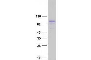 Validation with Western Blot (TBKBP1 Protein (Myc-DYKDDDDK Tag))