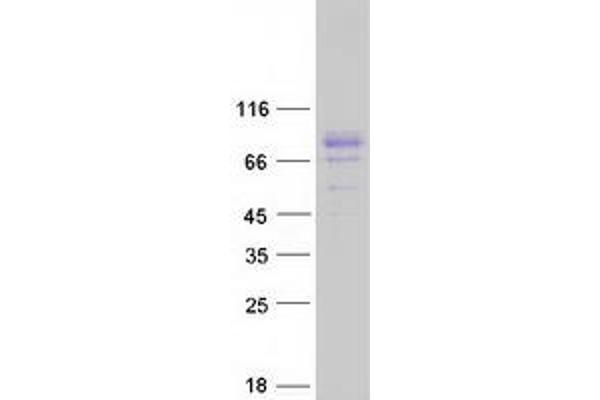 TBKBP1 Protein (Myc-DYKDDDDK Tag)