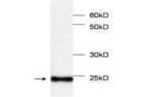 Image no. 1 for anti-Myoglobin (MB) antibody (ABIN791534) (Myoglobin 抗体)