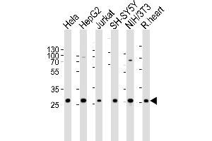 Western blot analysis of lysates from Hela, HepG2, Jurkat, SH-SY5Y, mouse NIH/3T3 cell line and rat heart tissue lysate(from left to right), using VB Antibody (Center) 20627c. (VAPB 抗体  (AA 126-139))