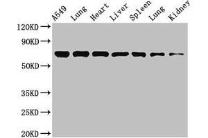 Western Blot Positive WB detected in: A549 whole cell lysate, Rat lung tissue, Mouse heart tissue, Mouse liver tissue, Mouse spleen tissue, Mouse lung tissue, Mouse kidney tissue All lanes: RPA1 antibody at 3. (RPA1 抗体  (AA 2-616))